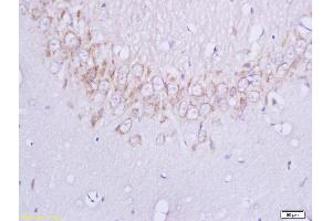 Formalin-fixed and paraffin embedded rat brain labeled with Anti-Plexin B1 Polyclonal Antibody, Unconjugated (ABIN749228) at 1:200 followed by conjugation to the secondary antibody and DAB staining (PLXNB1 antibody  (AA 151-250))