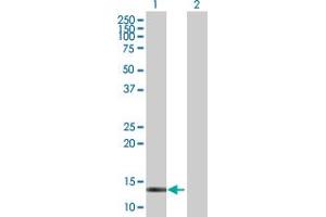 Western Blot analysis of CRABP2 expression in transfected 293T cell line by CRABP2 MaxPab polyclonal antibody. (CRABP2 antibody  (AA 1-138))