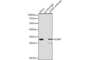 Immunoprecipitation analysis of 200 μg extracts of MCF-7 cells, using 3 μg COMT antibody (ABIN1679321, ABIN3015439, ABIN3015440 and ABIN6216759).