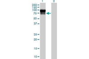 Western Blotting (WB) image for anti-Serpin Peptidase Inhibitor, Clade G (C1 Inhibitor), Member 1 (SERPING1) (AA 1-500) antibody (ABIN513845)