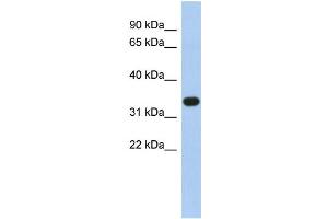 WB Suggested Anti-SULT1B1 Antibody Titration:  0. (SULT1B1 antibody  (N-Term))