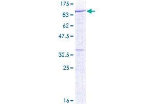 DYNC1I2 Protein (AA 1-612) (GST tag)