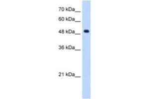 Western Blotting (WB) image for anti-Septin 6 (SEPT6) antibody (ABIN2462958) (Septin 6 antibody)