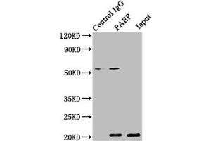 Immunoprecipitating PAEP in 293T whole cell lysate Lane 1: Rabbit control IgG instead of ABIN7154198 in 293T whole cell lysate. (PAEP antibody  (AA 19-180))