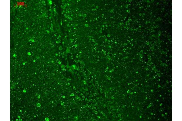 CACNA1C antibody  (AA 1507-1733) (HRP)