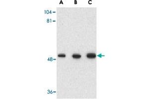 Western blot analysis of GOPC in rat colon cell lysate with GOPC polyclonal antibody  at (A) 1, (B) 2 and (C) 4 ug/mL . (GOPC antibody  (C-Term))