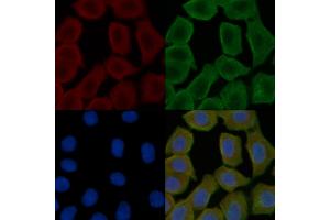 ABIN6258508 and ABIN6274718 staining Hela cells(30 min of UV treatment) by IF/ICC. (MRPS16 antibody  (Internal Region))