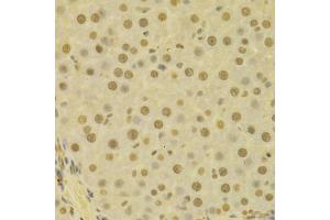Immunohistochemistry of paraffin-embedded human liver using COPS5 antibody (ABIN5970887) at dilution of 1/100 (40x lens).