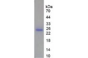 SDS-PAGE of Protein Standard from the Kit  (Highly purified E. (MMP13 ELISA Kit)