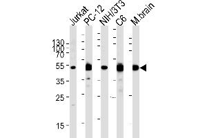 Western blot analysis of lysates from Jurkat,rat PC-12,mouse NIH/3T3,rat C6 cell line and mouse brain tissue (from left to right),using P2K1 Antibody (P1) (ABIN1882101 and ABIN2842058). (MEK1 antibody  (N-Term))