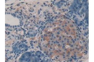 IHC-P analysis of Rat Pancreas Tissue, with DAB staining. (IGF2R antibody  (AA 1146-1363))