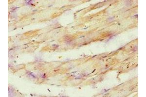 Immunohistochemistry of paraffin-embedded human skeletal muscle tissue using ABIN7144869 at dilution of 1:100 (ATP5O antibody  (AA 24-213))