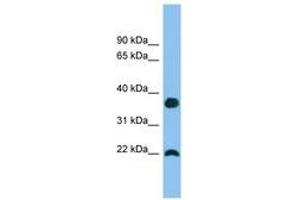 Image no. 1 for anti-WAP Four-Disulfide Core Domain 1 (WFDC1) (C-Term) antibody (ABIN6745156) (WFDC1 antibody  (C-Term))