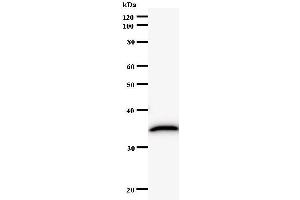 Western Blotting (WB) image for anti-RAR-Related Orphan Receptor C (RORC) antibody (ABIN932197) (RORC antibody)