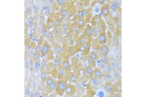 Immunohistochemistry of paraffin-embedded mouse liver using AARS antibody (ABIN7265526) at dilution of 1:100 (40x lens). (AARS antibody  (AA 1-100))