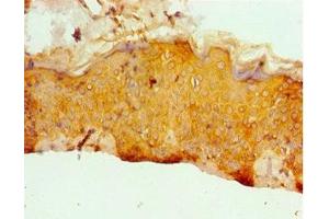 Immunohistochemistry of paraffin-embedded human skin tissue using ABIN7171955 at dilution of 1:100 (ERCC2 antibody  (AA 1-300))