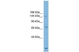 ABCB1 antibody used at 1 ug/ml to detect target protein. (ABCB1 antibody)