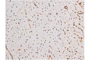 ABIN6267354 at 1/200 staining Mouse heart tissue sections by IHC-P. (MAPT antibody  (pSer235))