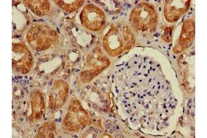 Immunohistochemistry of paraffin-embedded human kidney tissue using ABIN7149804 at dilution of 1:100 (DDA1 antibody  (AA 1-102))