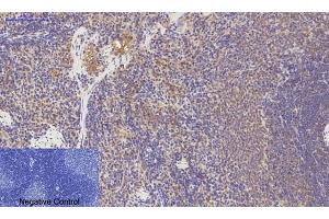 Immunohistochemical analysis of paraffin-embedded rat spleen tissue. (PDGFRA antibody)