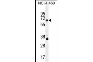 ZN Antibody (N-term) (ABIN655452 and ABIN2844980) western blot analysis in NCI- cell line lysates (35 μg/lane). (ZNF433 antibody  (N-Term))
