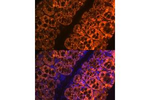 Immunofluorescence analysis of mouse large intestine using Galectin 4/LG Rabbit mAb (ABIN1679347, ABIN3017979, ABIN3017980 and ABIN7101554) at dilution of 1:100 (40x lens).