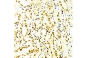 Immunohistochemistry of paraffin-embedded Human kidney using DKC1 antibody at dilution of 1:100 (x400 lens). (DKC1 antibody  (AA 245-514))