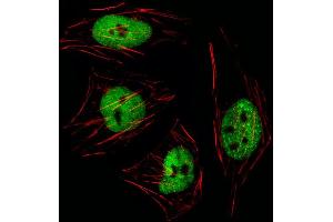 Fluorescent image of Hela cell stained with GTF2I Antibody (N-term) (ABIN1539271 and ABIN2849619)/SA111012BI. (GTF2I antibody  (N-Term))