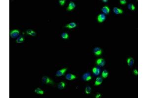 Immunofluorescence staining of Hela cells with ABIN7167196 at 1:400, counter-stained with DAPI. (RAC1 antibody  (AA 11-185))