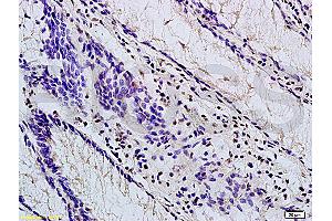 Formalin-fixed and paraffin embedded mouse stomach labeled with Anti-TBL1X Polyclonal Antibody, Unconjugated (ABIN705416) at 1:200 followed by conjugation to the secondary antibody and DAB staining (TBL1Y antibody  (AA 501-577))