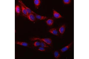 IF analysis of SUCLG1 using anti-SUCLG1 antibody (ABIN7600906).