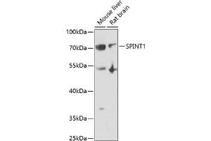 Western blot analysis of extracts of various cell lines, using SPINT1 antibody (ABIN6131743, ABIN6148359, ABIN6148360 and ABIN6222046) at 1:1000 dilution. (SPINT1 antibody  (AA 234-513))