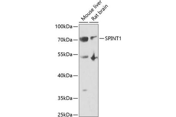 SPINT1 antibody  (AA 234-513)