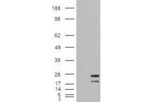 HEK293 overexpressing NRAS and probed with ABIN2564225 (mock transfection in first lane). (GTPase NRas antibody  (Internal Region))