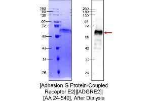 Western Blotting (WB) image for Adhesion G protein-coupled Receptor E2 (ADGRE2) (AA 24-540) protein (His tag) (ABIN3108059) (ADGRE2 Protein (AA 24-540) (His tag))
