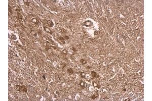 IHC-P Image UBE3A antibody detects UBE3A protein at cytosol on mouse middle brain by immunohistochemical analysis. (ube3a antibody)
