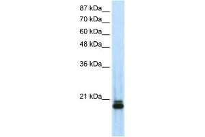 WB Suggested Anti-SAAntibody Titration:  0. (SAP18 antibody  (N-Term))