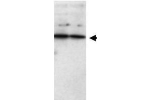 Western blot using  Affinity Purified anti-SFRP1 antibody shows detection of a band ~37 kDa (arrowhead) corresponding to SFRP1 in lysates from human cultured airway epithelial cells. (SFRP1 antibody)
