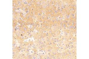 Immunohistochemistry analysis of paraffin embedded mouse Hippocampus using Nrg4 (ABIN7074805) at dilution of 1: 300 (Neuregulin 4 antibody)