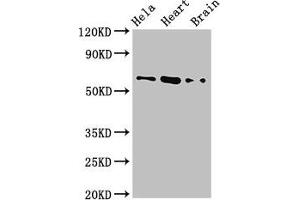 Western Blot Positive WB detected in: Hela whole cell lysate, Mouse heart tissue, Mouse brain tissue All lanes: BAIAP2 antibody at 3. (BAIAP2 antibody  (AA 123-368))