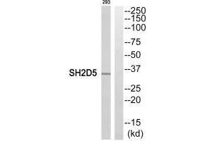 Western blot analysis of extracts from 293 cells, using SH2D5 antibody. (SH2D5 antibody  (C-Term))