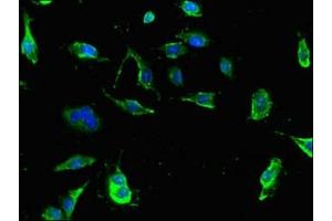 Immunofluorescent analysis of U251 cells using ABIN7173610 at dilution of 1:100 and Alexa Fluor 488-congugated AffiniPure Goat Anti-Rabbit IgG(H+L) (Tryptophan Hydroxylase 1 antibody  (AA 257-405))