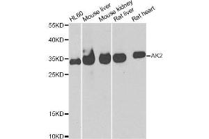 Western blot analysis of extracts of various cell lines, using AK2 antibody. (Adenylate Kinase 2 antibody  (AA 1-232))