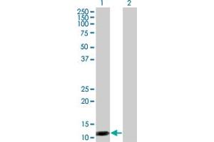 Western Blot analysis of S100A7 expression in transfected 293T cell line by S100A7 monoclonal antibody (M01), clone 1C5-C6. (S100A7 antibody  (AA 1-101))