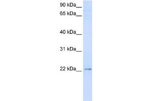 WB Suggested Anti-TMEM9 Antibody Titration:  0. (TMEM9 antibody  (C-Term))