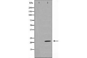 Western blot analysis on rat liver cell lysate using Claudin 7 Antibody,The lane on the left is treated with the antigen-specific peptide. (Claudin 7 antibody  (C-Term))