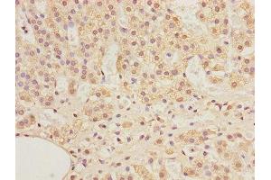 Immunohistochemistry of paraffin-embedded human adrenal gland tissue using ABIN7143266 at dilution of 1:100 (ADAMDEC1 antibody  (AA 206-470))