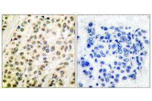 Immunohistochemistry (IHC) image for anti-Transglutaminase 4 (Prostate) (TGM4) (C-Term) antibody (ABIN5976383) (TGM4 antibody  (C-Term))