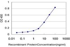 Detection limit for recombinant GST tagged ERN1 is approximately 1ng/ml as a capture antibody. (ERN1 antibody  (AA 401-500))