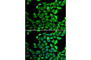 Immunofluorescence analysis of U20S cell using PPID antibody.